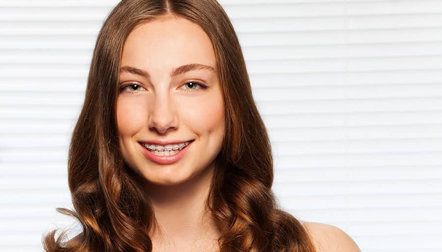 Ceramic Braces: The Advantages and Disadvantages