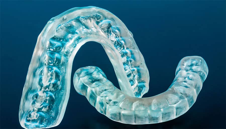 Living with Invisalign – Some Important Facts You Need to Know